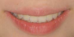 normalsmile.jpg