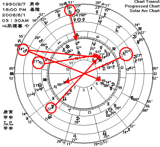 心肌梗塞02.gif