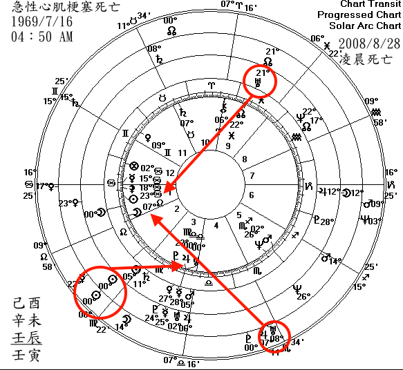 心肌梗塞.gif