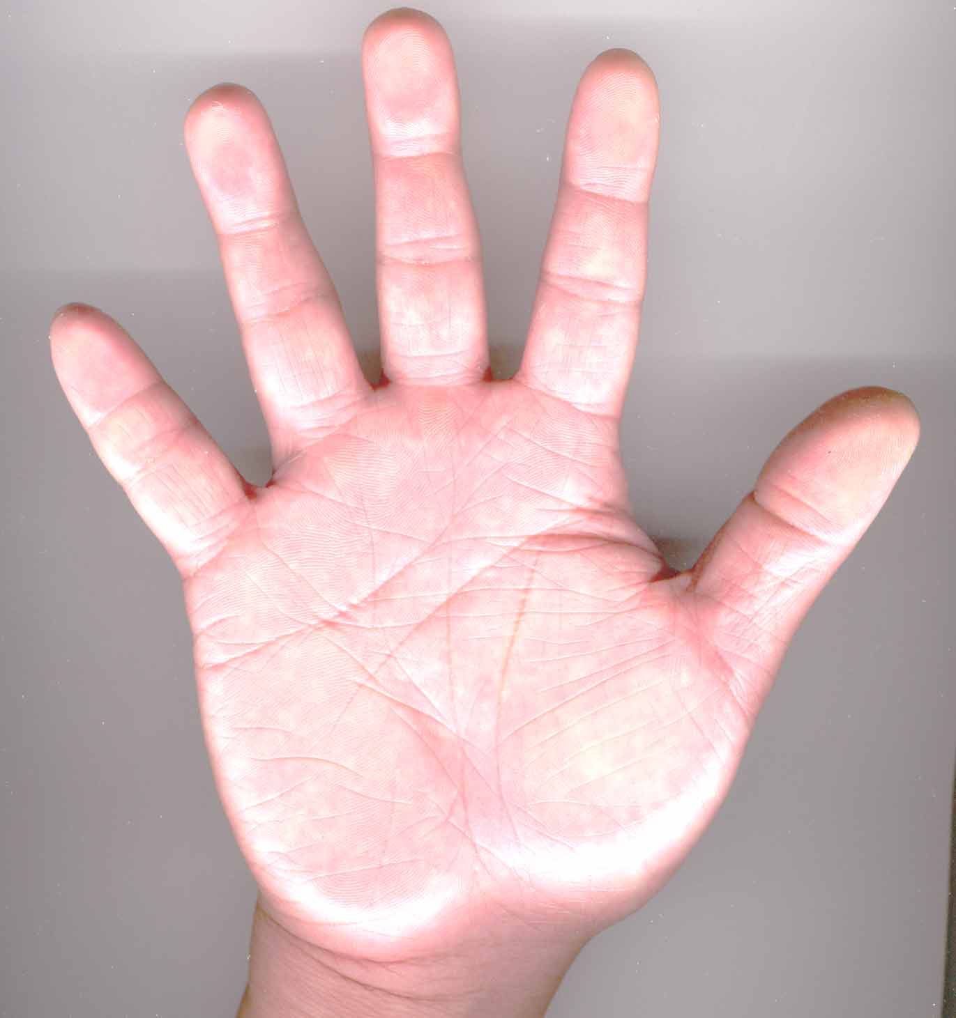 156545-rhand.jpg