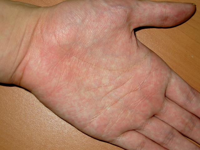 182424-hand.jpg