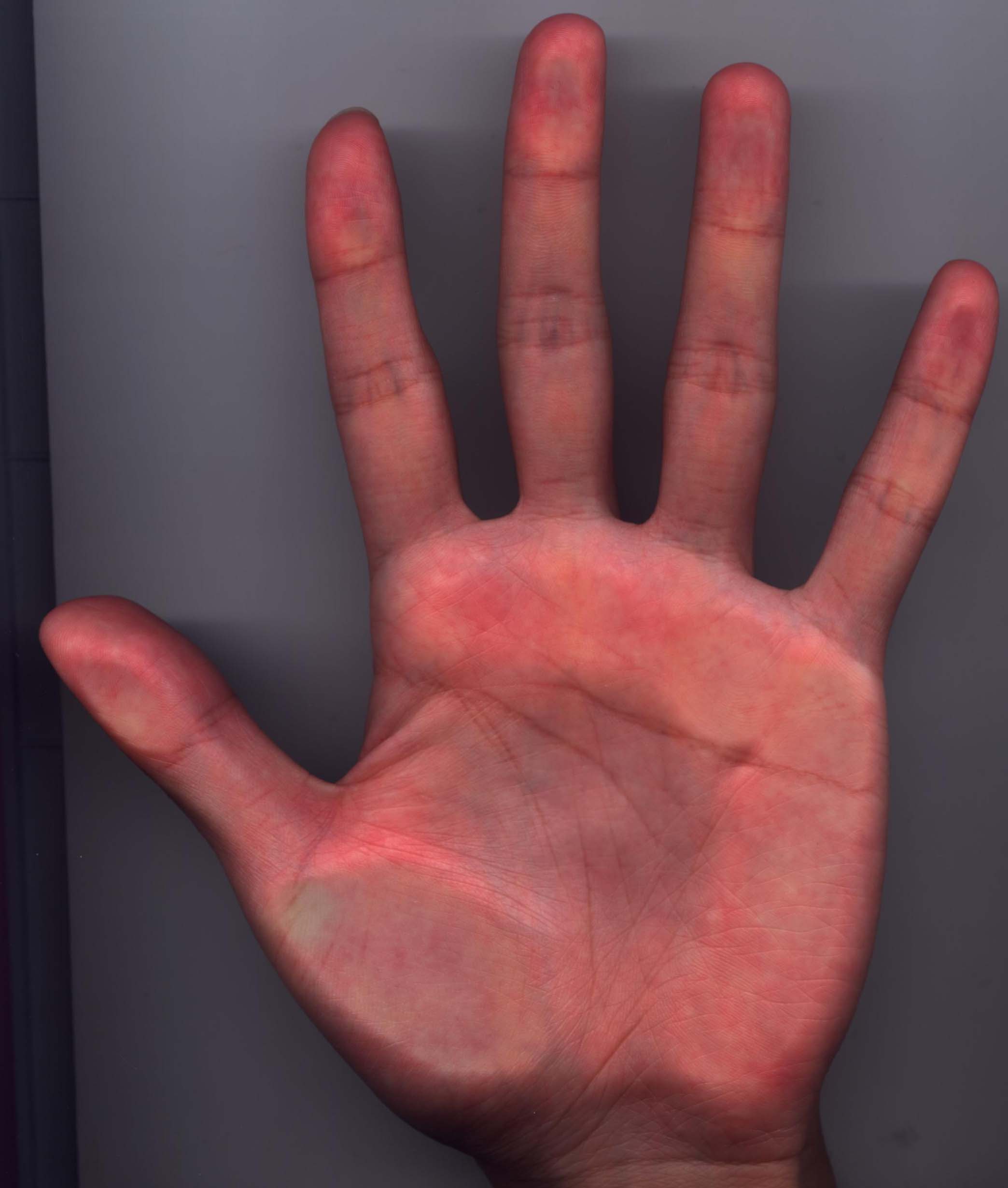 191689-palm3.jpg