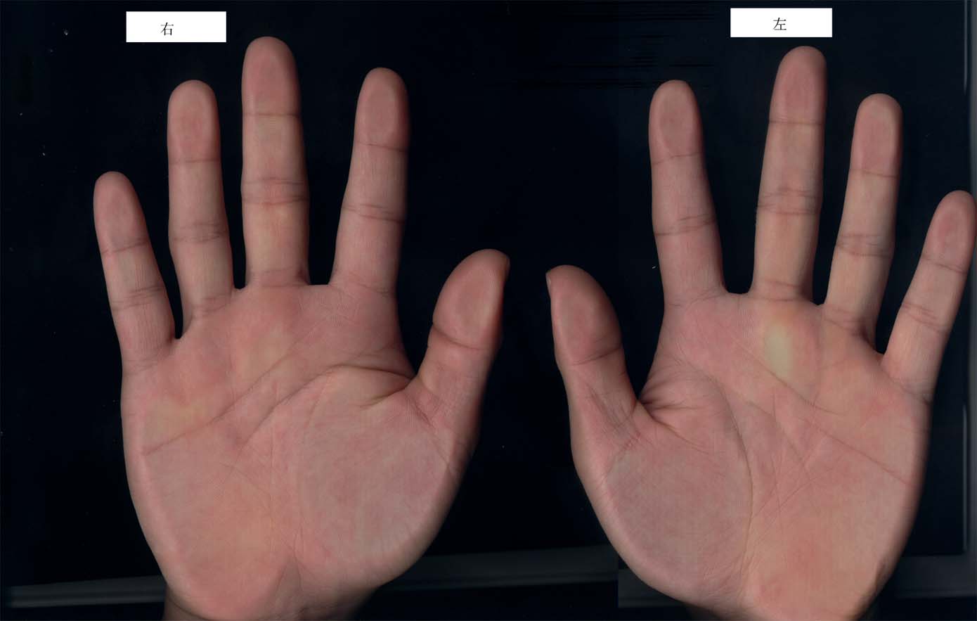 193446-hand.jpg