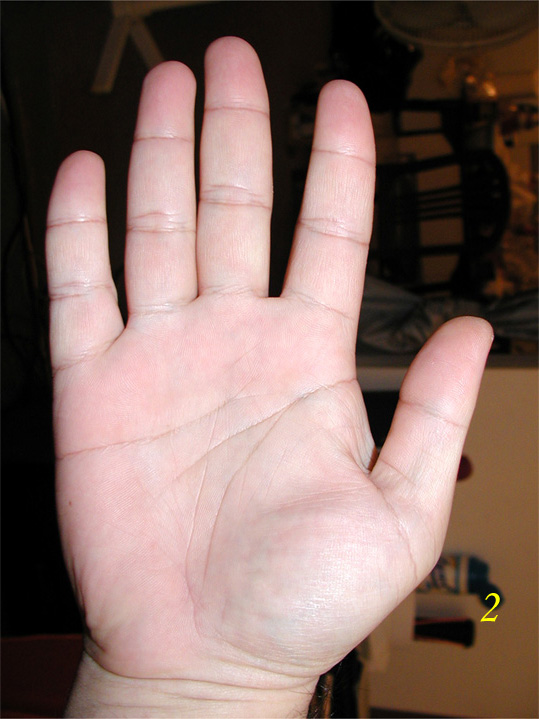 225646-right.jpg