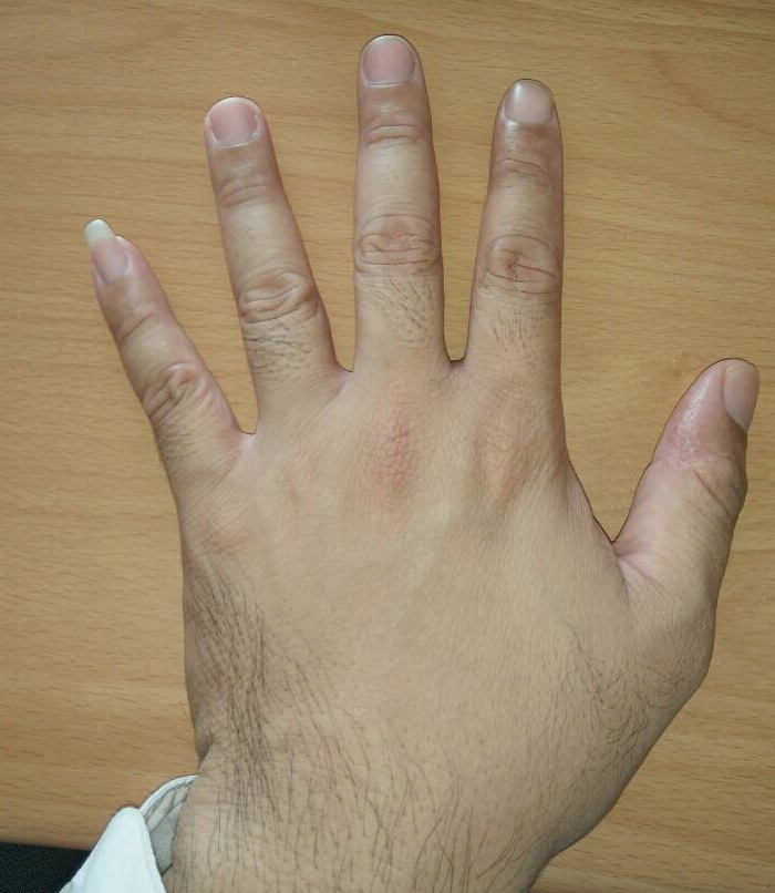 11157.jpg