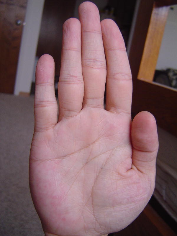655599-right.jpg