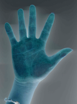 18-44211-t1.gif