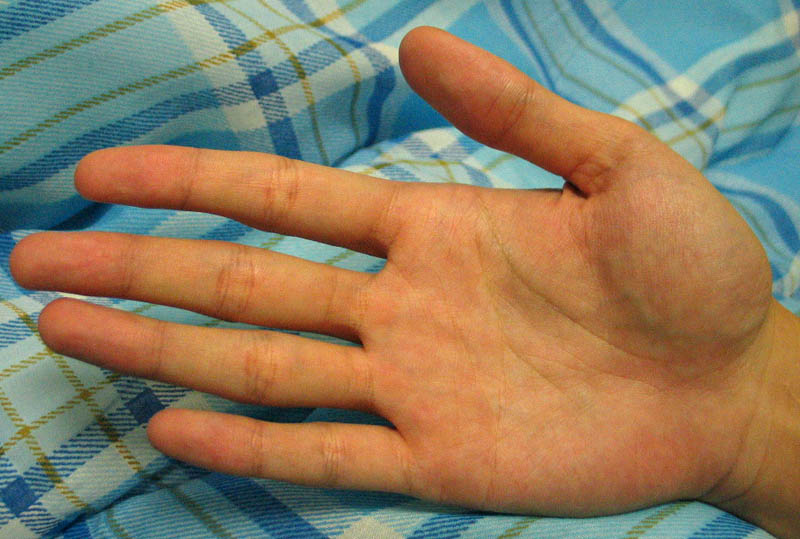 759554-right_palm.jpg